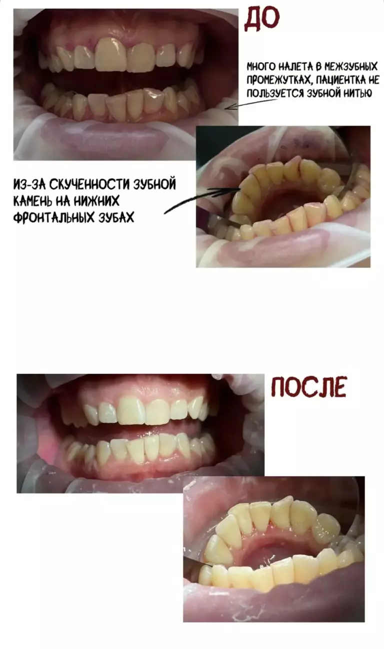 Фотография 1