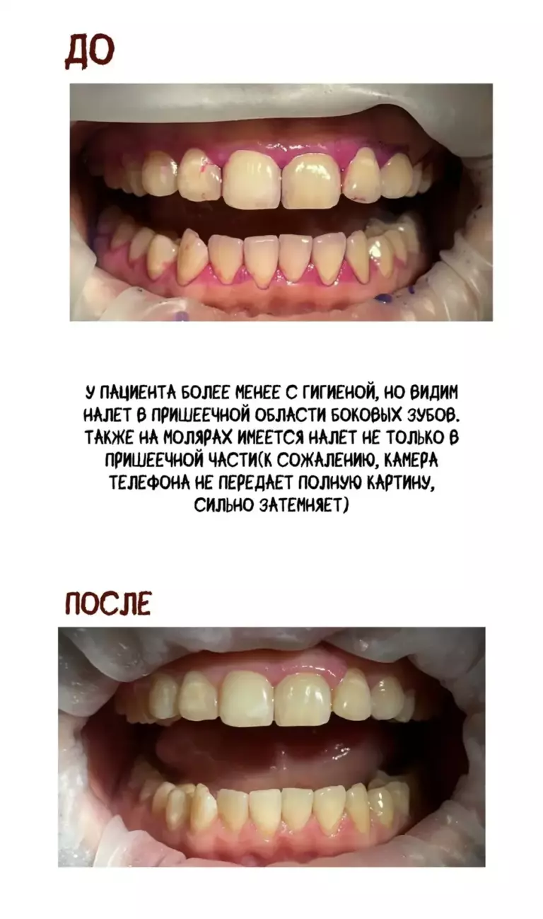 Фотография 3