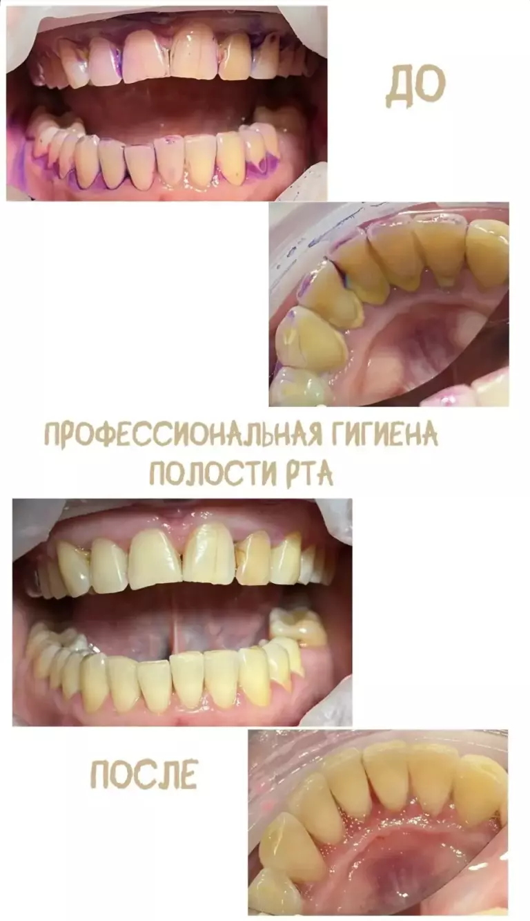 Фотография 4