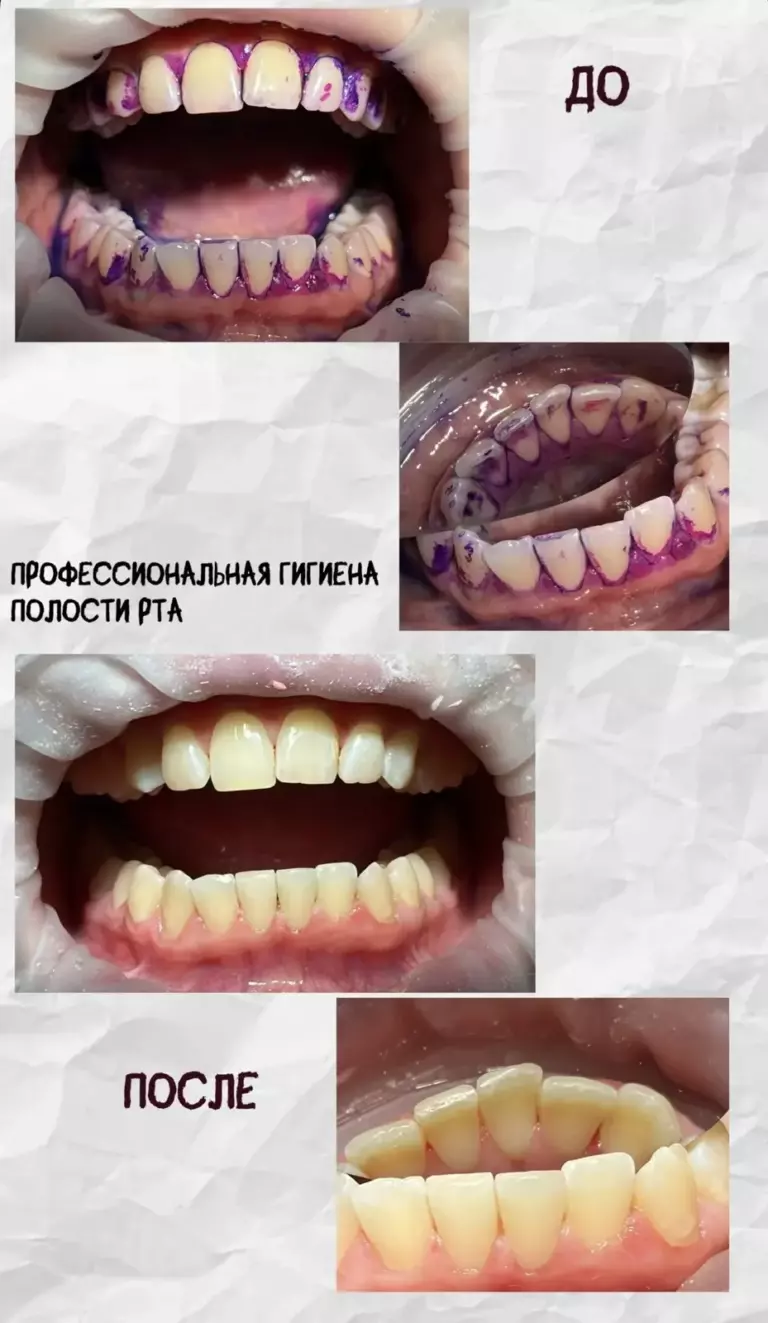 Фотография 6