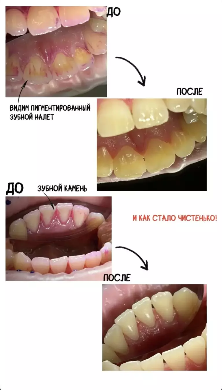 Фотография 10