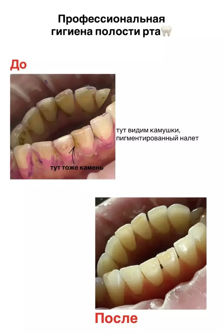 Фотография 11